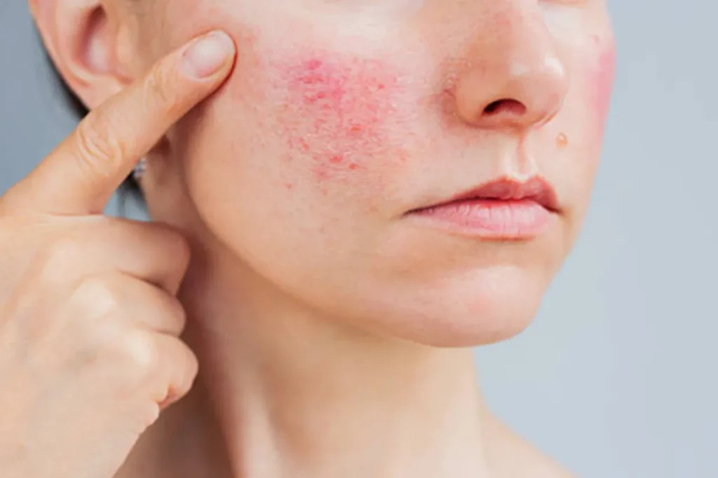 pva use for Cosmetics